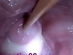 Insertion Semen Cum in Cervix Broad Opening Up Pussy Speculum