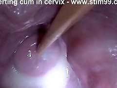 Insertion Semen Cum in Cervix Wide Stretching Pussy Buttplug