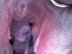 Spunk Injection with Syringe in Cervix Uterus after Pounding