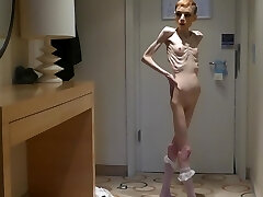 Anorexia Christin showing her Bones & Skinny Skeleton