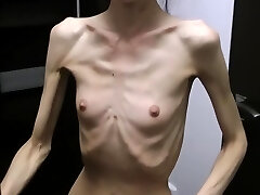 Anorexic Denisa posing and has ribs fumbled