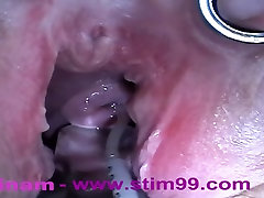 Extreme tied tickle orgasm Fisting, Huge Objects, Cervix Insertion, Peehole Fucking, Nettles, Electro Orgasms and Saline Injection