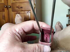 Stretch foreskin session - metal tongs